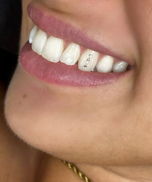 Tooth gem aplicado numa cliente do Daniela Studio